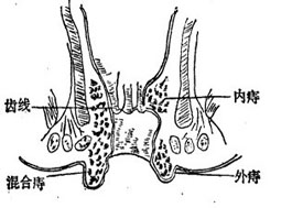 混合痔